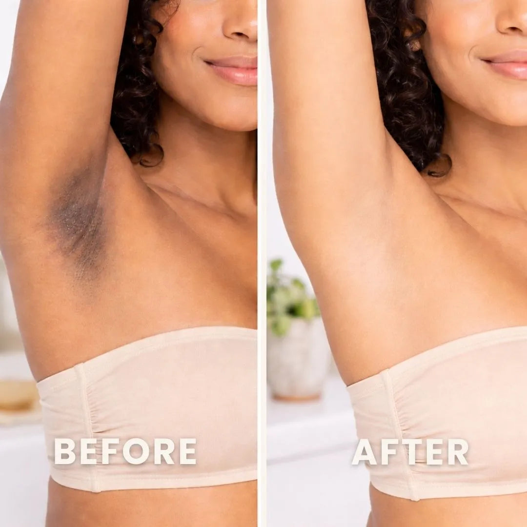 PuraPeel® Vitamin C Glow Peel