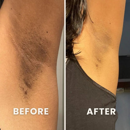 PuraPeel® Vitamin C Glow Peel