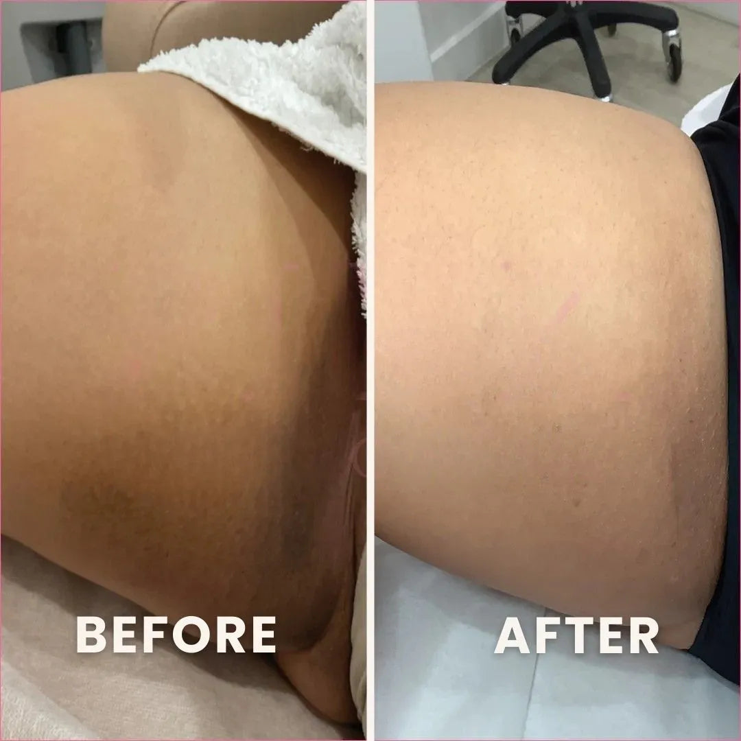 PuraPeel® Vitamin C Glow Peel