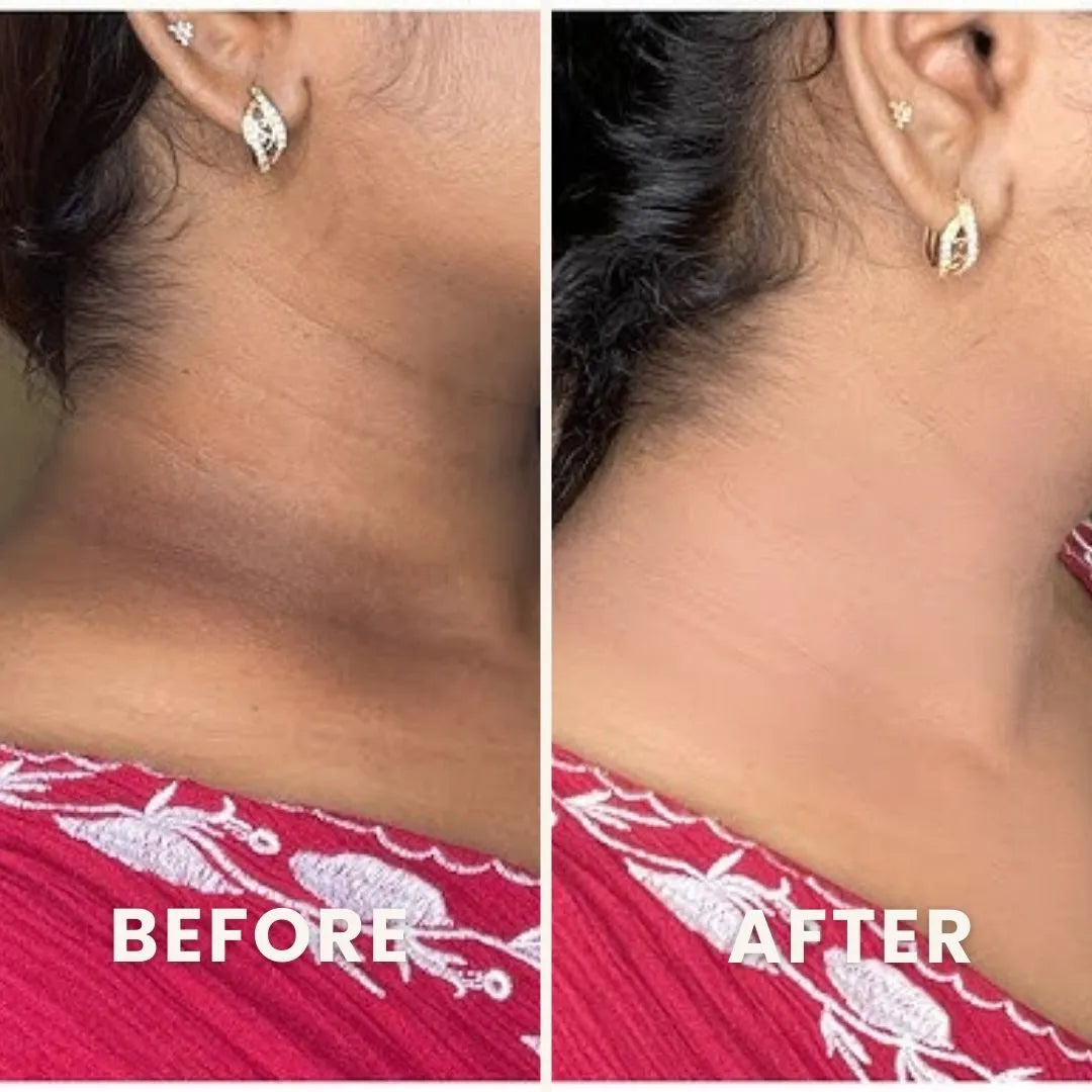 PuraPeel® Vitamin C Glow Peel