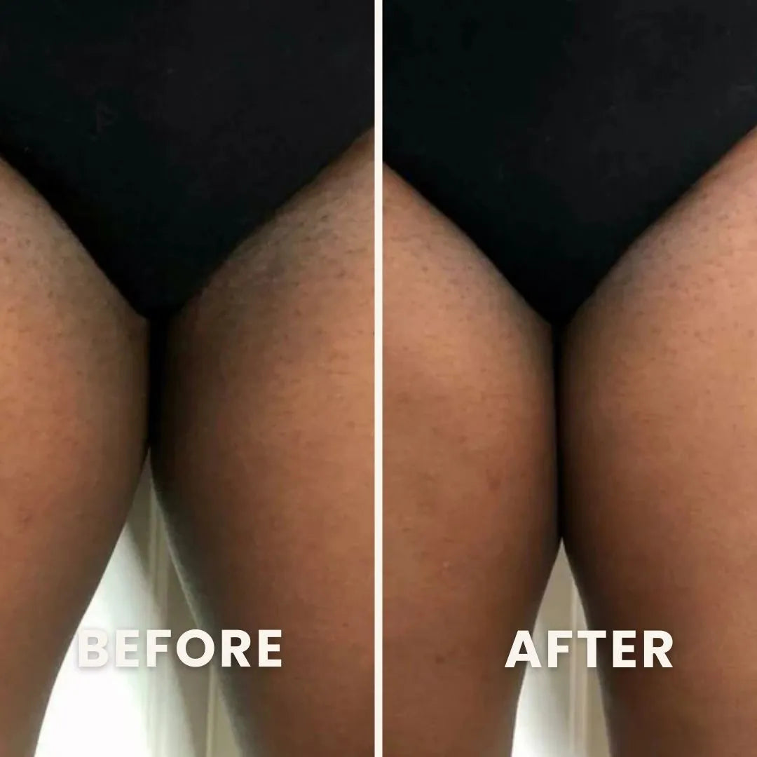 PuraPeel® Vitamin C Glow Peel