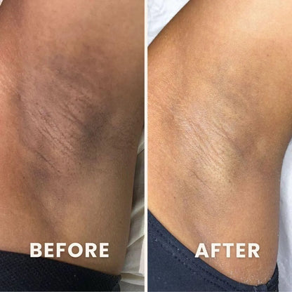 PuraPeel® Vitamin C Glow Peel